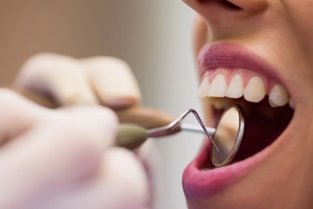 Close-up of dental checkup with mirror tool in a female patient's mouth
